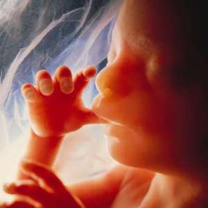 Unborn Child